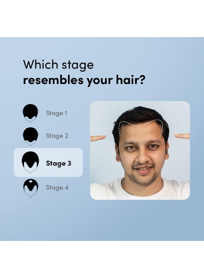 Man Matters 5% Minoxidil + 0.1% Finasteride Solution 60ml | For Hair Loss & Hair Growth |  (Pack of 2) - Image 4